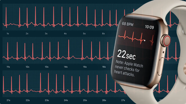 Wearables en Gezondheidsmonitoring